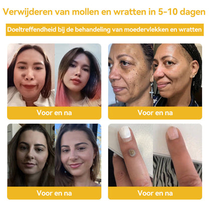 🐝🎁𝑭𝑹𝑶𝑷𝑼𝑵™ 𝑩𝒊𝒋𝒆𝒏𝒈𝒊𝒇 𝑾𝒓𝒂𝒕𝒕𝒆𝒏 & 𝑴𝒐𝒆𝒅𝒆𝒓𝒗𝒍𝒆𝒌𝒌𝒆𝒏𝑽𝒆𝒓𝒘𝒊𝒋𝒅𝒆𝒓𝒊𝒏𝒈𝒔 𝑪𝒓è𝒎𝒆🔥( 𝑳𝒂𝒂𝒕𝒔𝒕𝒆 𝒅𝒂𝒈 𝒑𝒓𝒐𝒎𝒐𝒕𝒊𝒆 80%0𝒇𝒇）